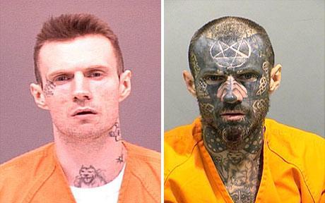 tattoo-removal-before-after.