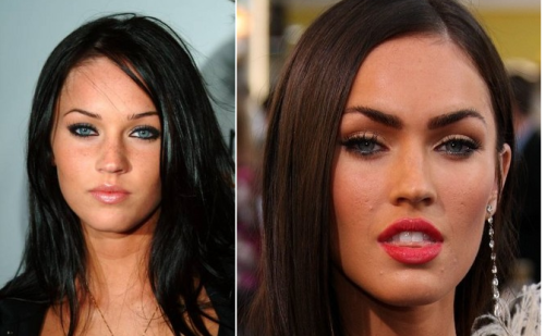 Megan Fox Before And After Surgery. Megan Fox- efore and after
