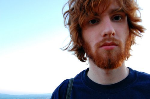 Scruffy looking Gingers with dead eyes can get it