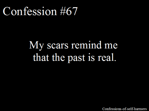 My scars remind me that the past is real.