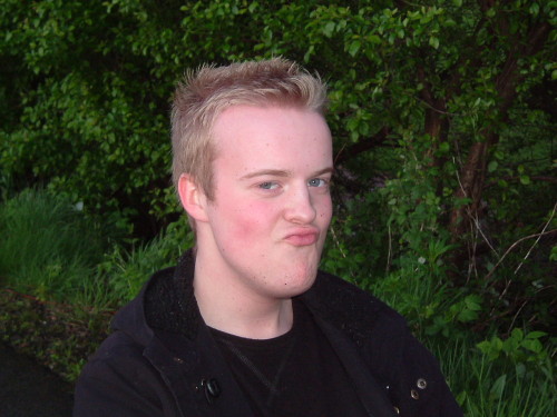 this scottish duckface doesn’t seem to realize that making this face means his facial features are absolutely dwarfed by that giant fucking forehead and chin of his.